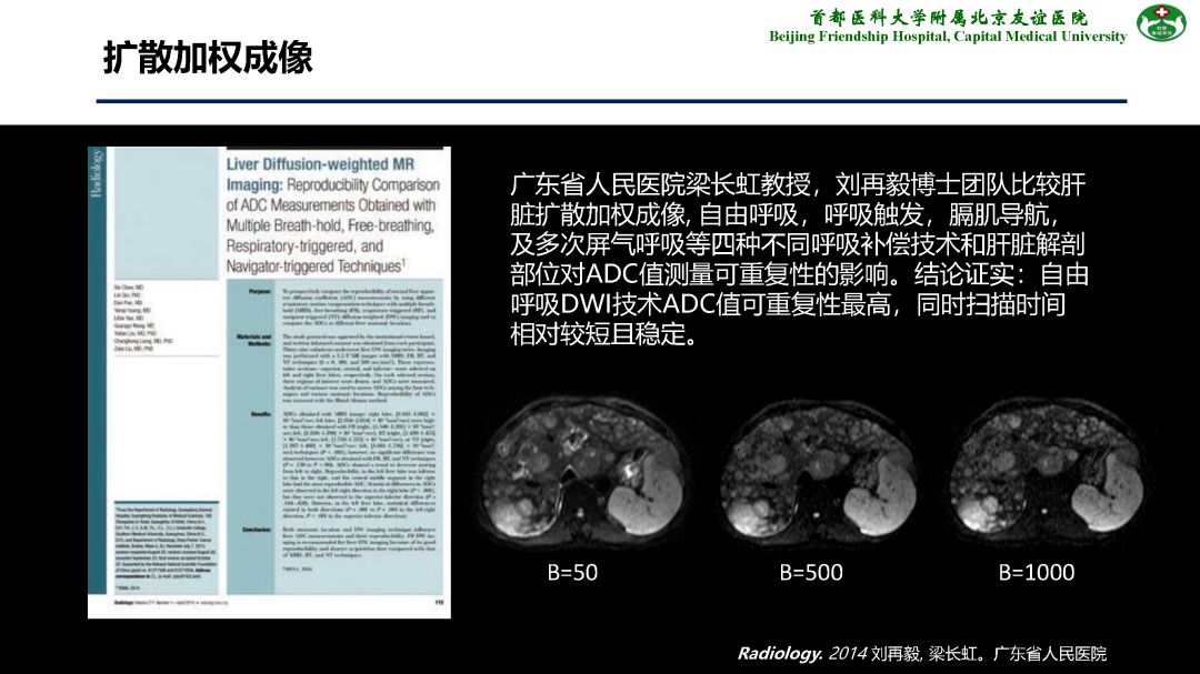 【PPT】肝脏MRI检查技术规范