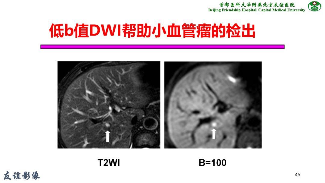 【PPT】肝脏MRI检查技术规范