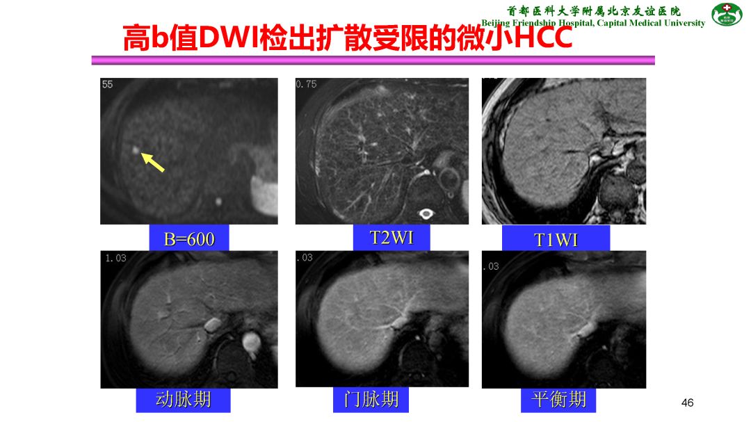 【PPT】肝脏MRI检查技术规范