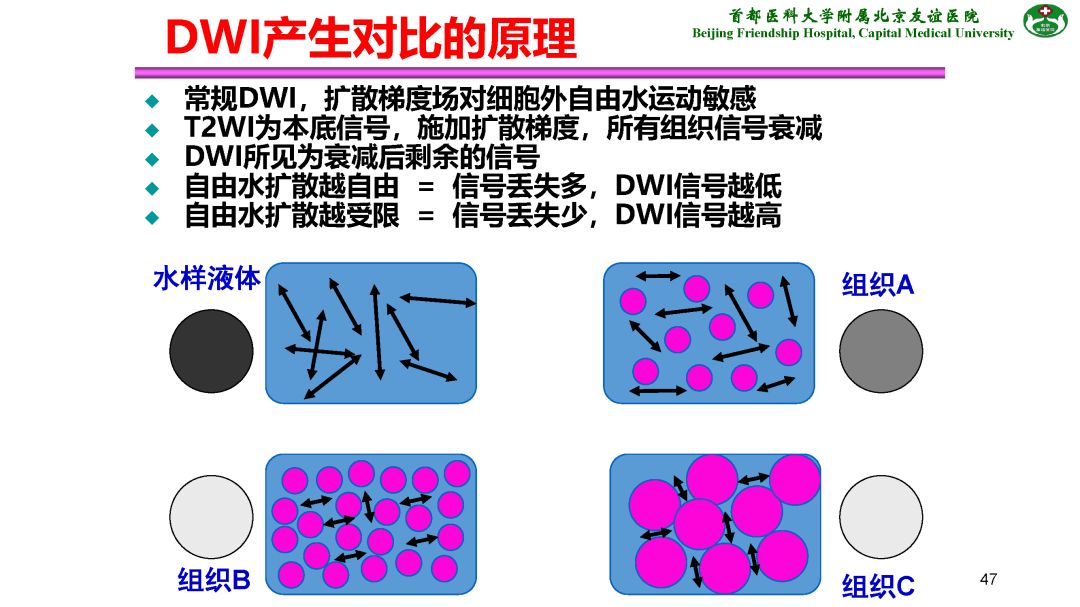 【PPT】肝脏MRI检查技术规范