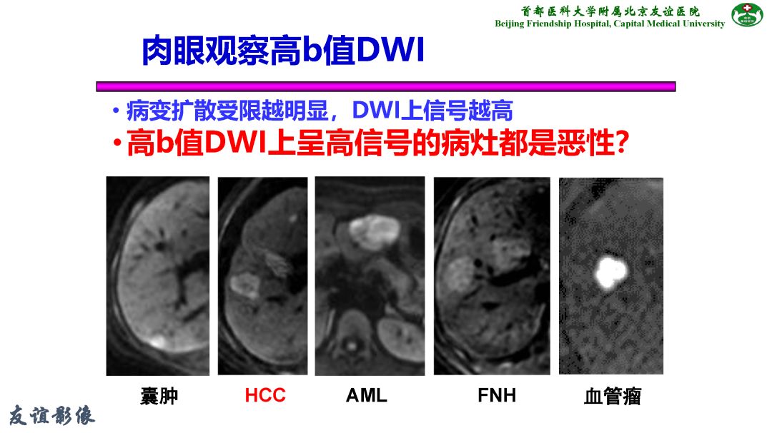 【PPT】肝脏MRI检查技术规范
