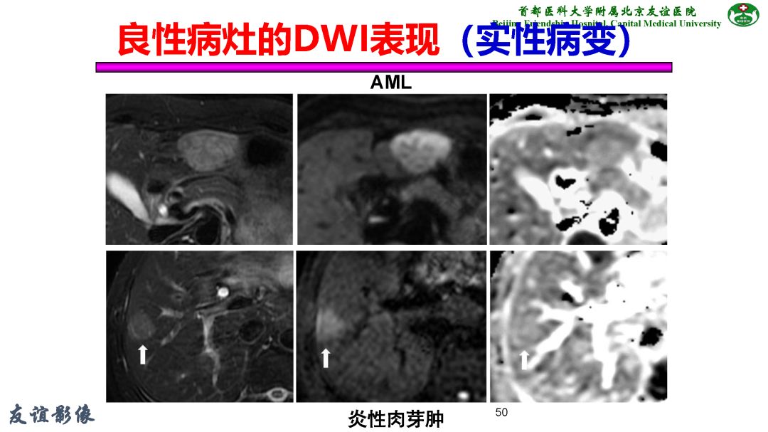 【PPT】肝脏MRI检查技术规范