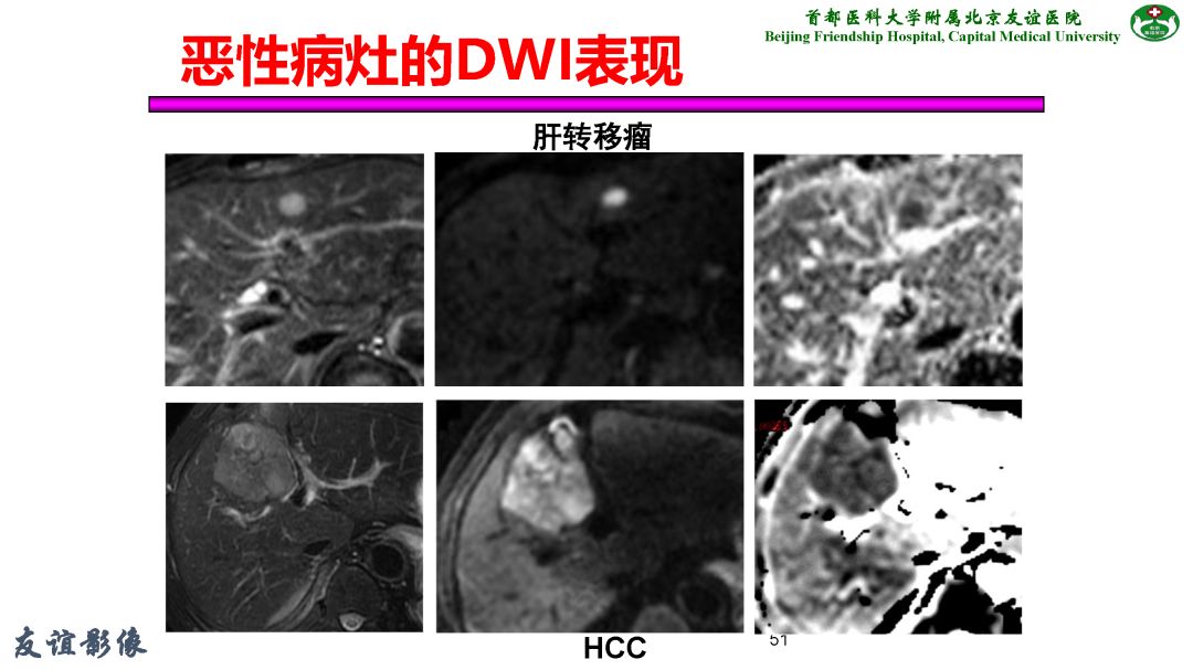 【PPT】肝脏MRI检查技术规范