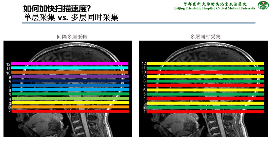【PPT】肝脏MRI检查技术规范