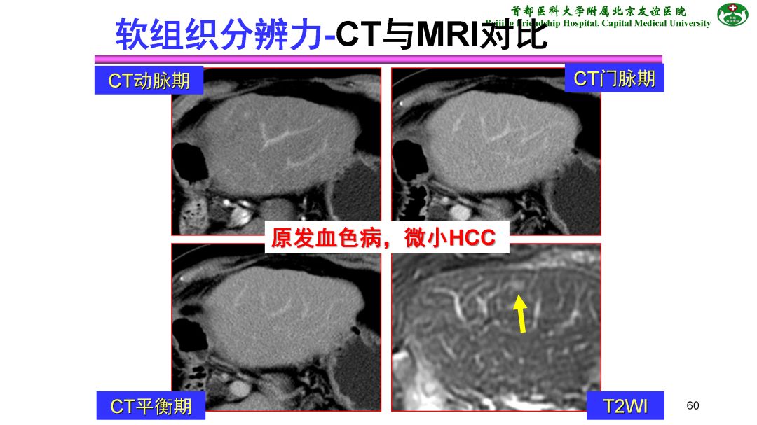 【PPT】肝脏MRI检查技术规范