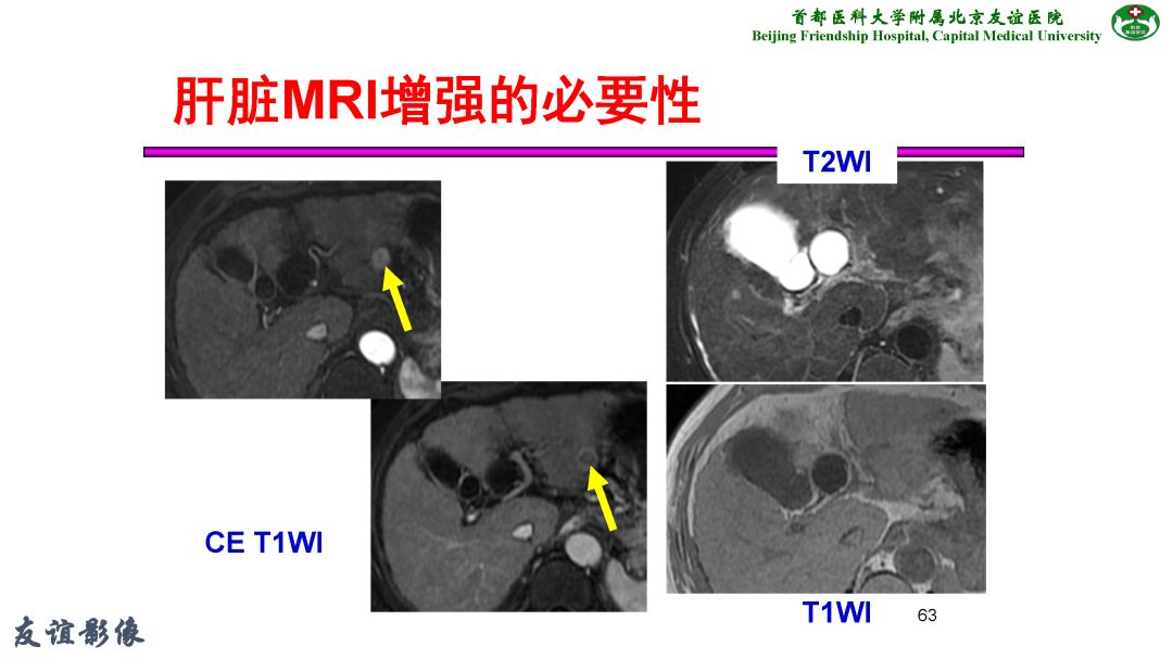 【PPT】肝脏MRI检查技术规范