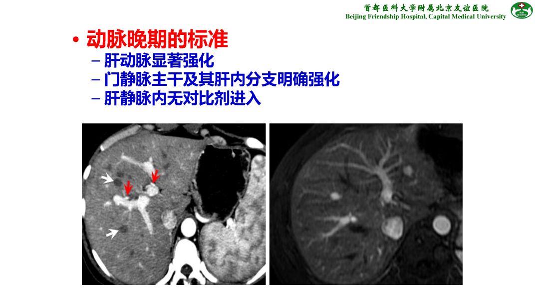 【PPT】肝脏MRI检查技术规范
