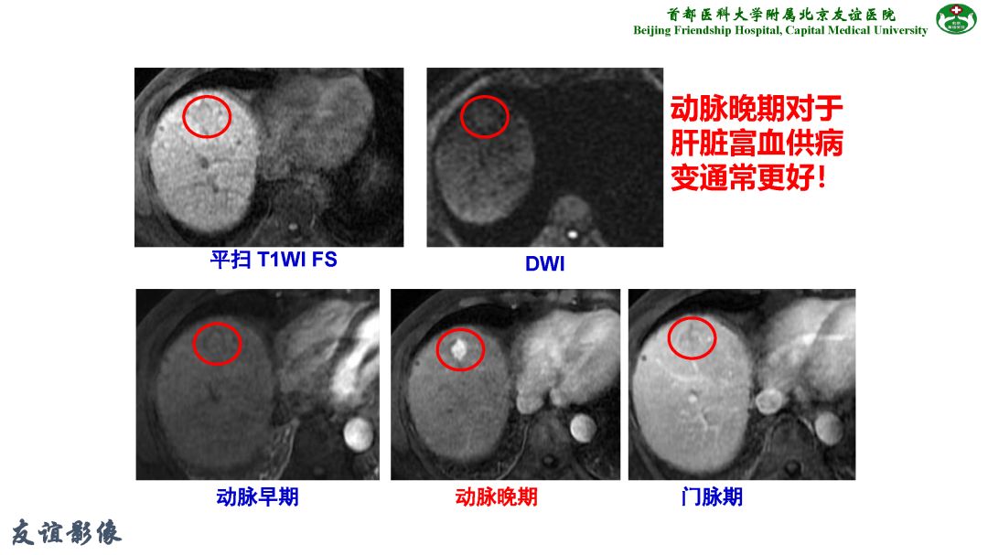 【PPT】肝脏MRI检查技术规范
