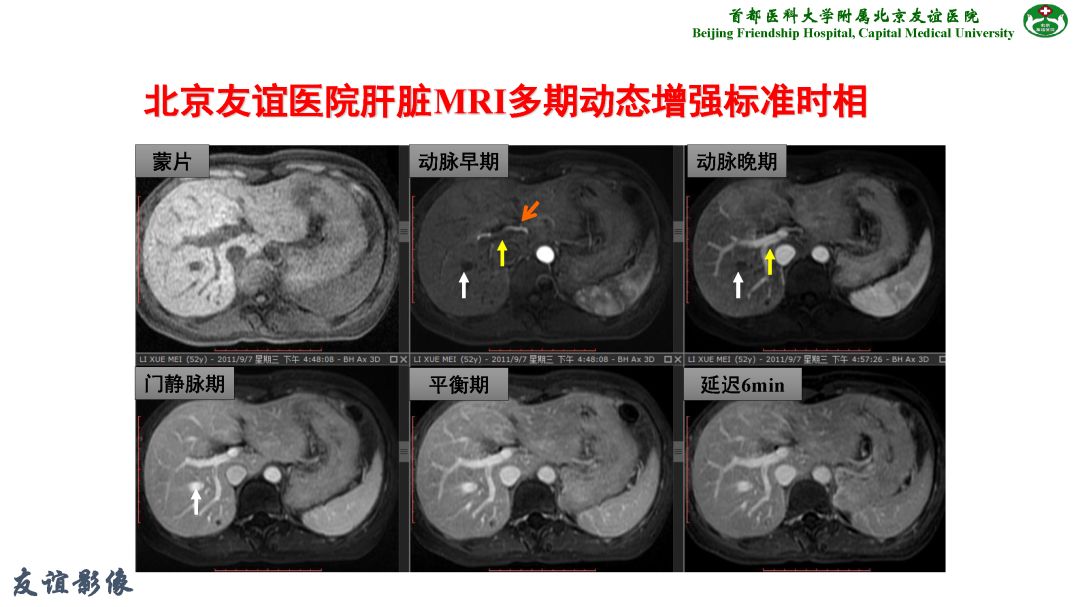 【PPT】肝脏MRI检查技术规范