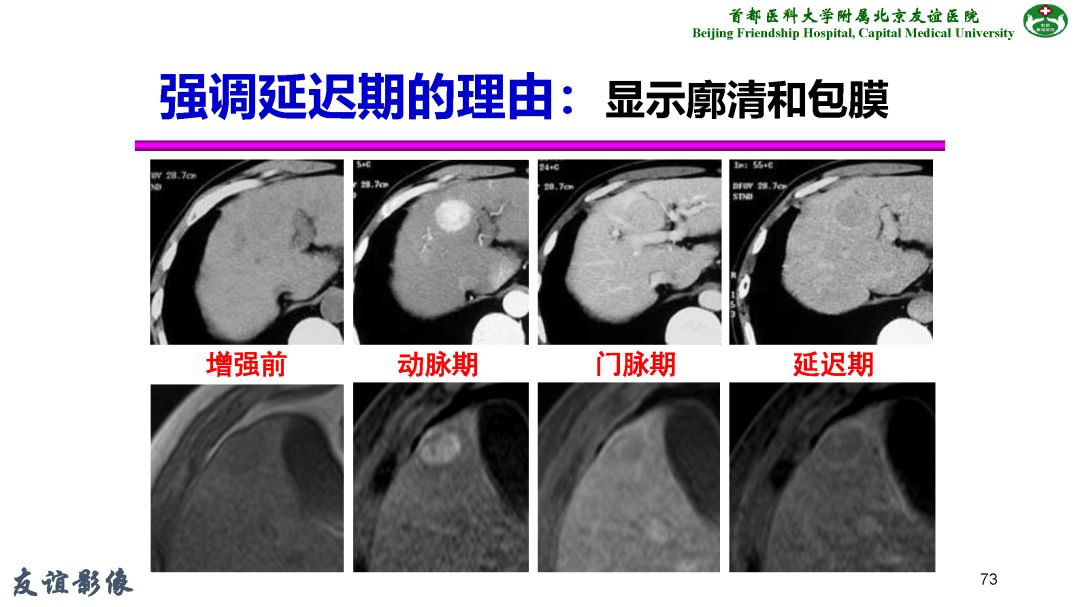 【PPT】肝脏MRI检查技术规范