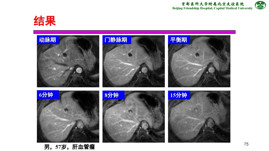 【PPT】肝脏MRI检查技术规范