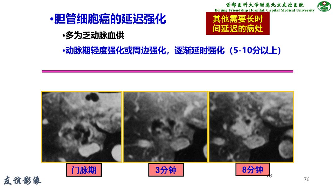 【PPT】肝脏MRI检查技术规范