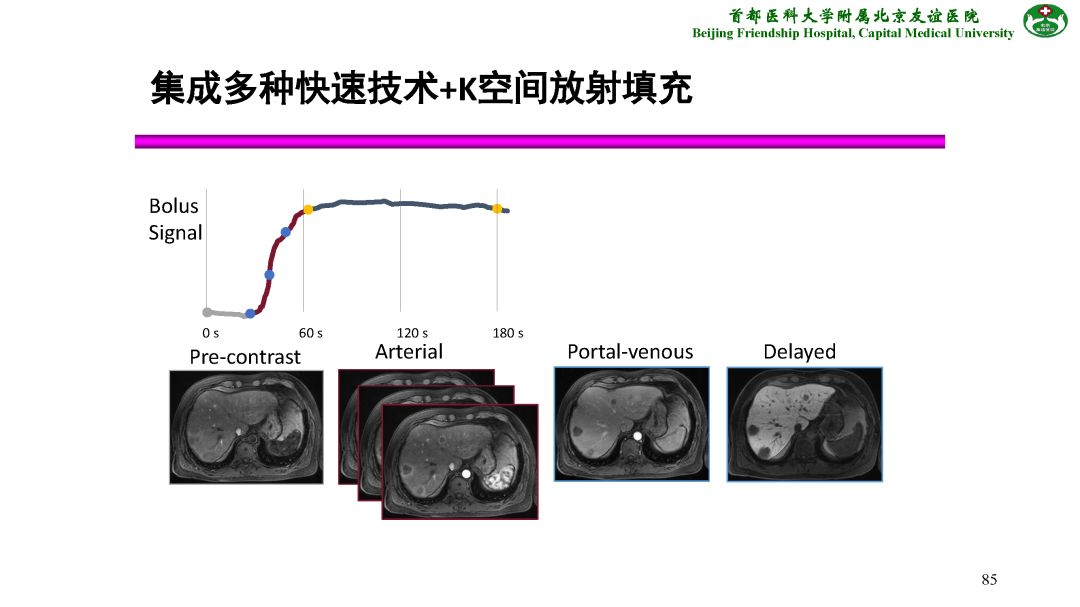 【PPT】肝脏MRI检查技术规范