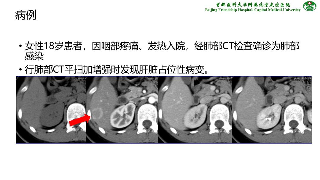 【PPT】肝脏MRI检查技术规范
