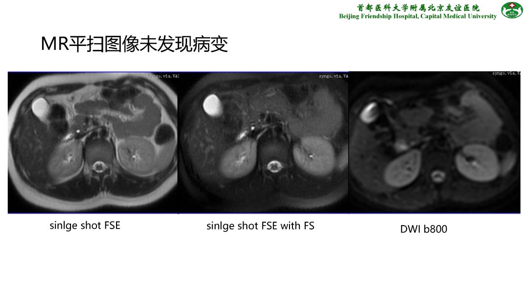 【PPT】肝脏MRI检查技术规范