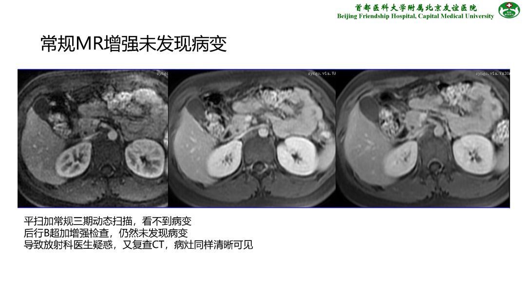 【PPT】肝脏MRI检查技术规范