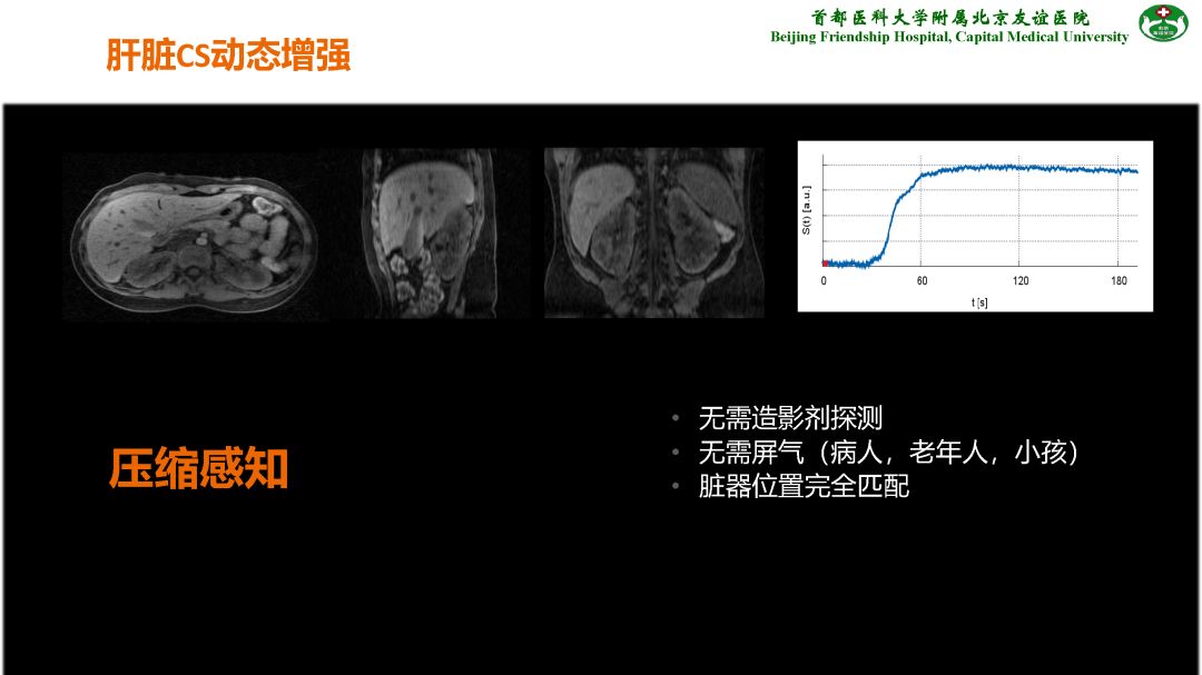 【PPT】肝脏MRI检查技术规范