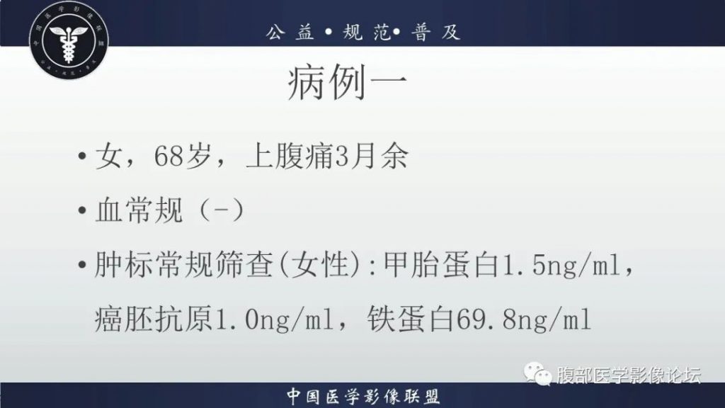 【病例】淋巴瘤与胃癌各1例CT影像