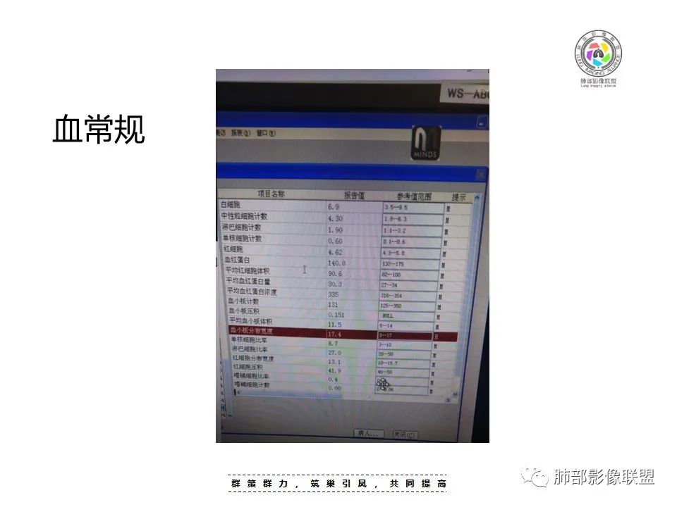 【病例】良恶一念间——肺部病变分析1例 【病例】良恶一念间——肺部病变分析1例