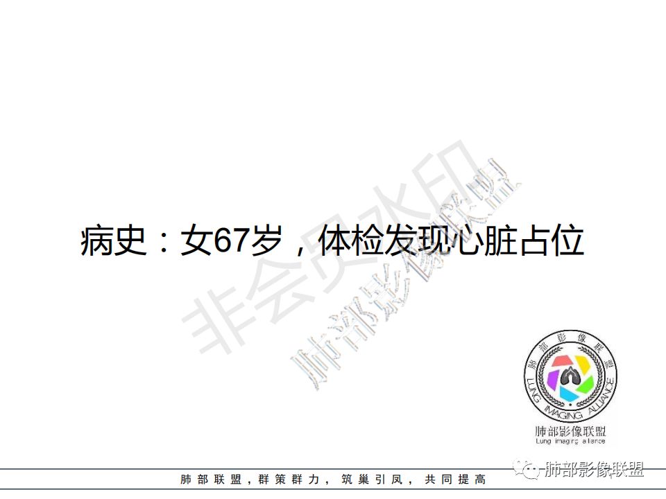 【病例】心包海绵状血管瘤1例CT影像 【病例】心包海绵状血管瘤1例CT影像
