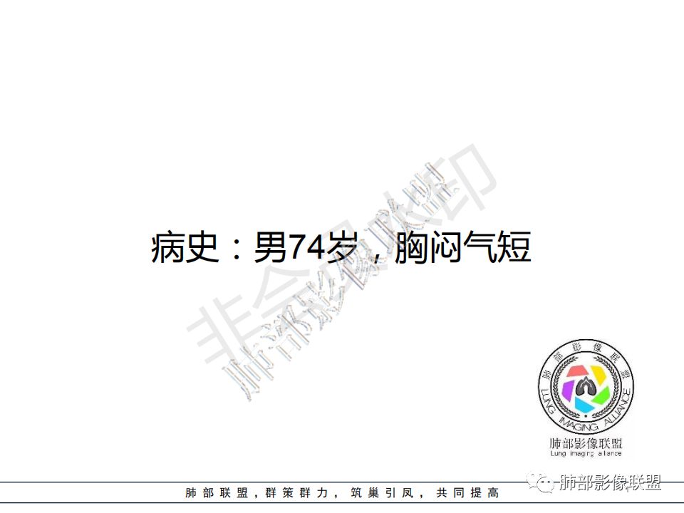 【病例】心脏血管肉瘤1例CT影像 【病例】心脏血管肉瘤1例CT影像