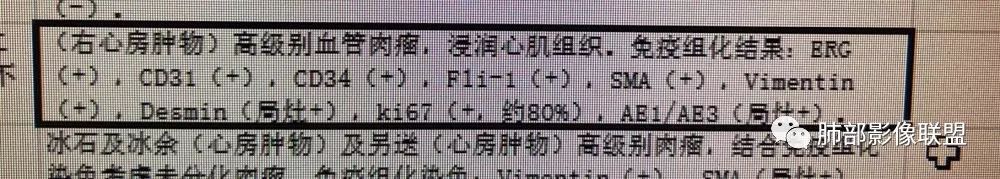 【病例】心脏血管肉瘤1例CT影像 【病例】心脏血管肉瘤1例CT影像
