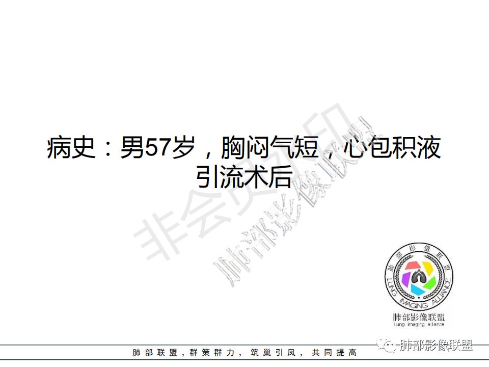 【病例】心包恶性间皮瘤1例CT影像 【病例】心包恶性间皮瘤1例CT影像