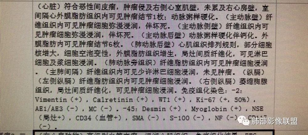 【病例】心包恶性间皮瘤1例CT影像 【病例】心包恶性间皮瘤1例CT影像