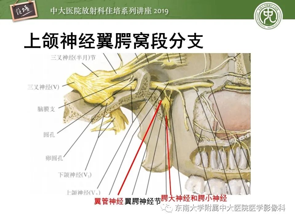 【PPT】翼腭窝的影像解剖及临床意义