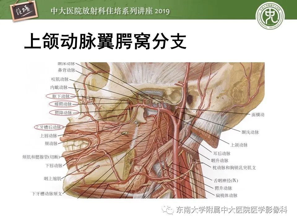 【PPT】翼腭窝的影像解剖及临床意义