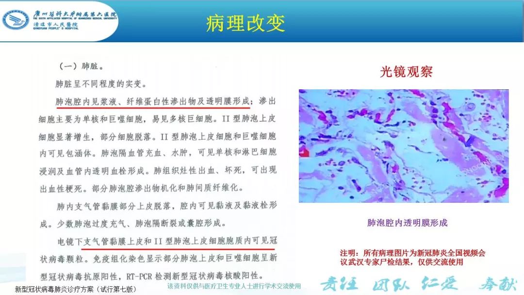 【PPT】新冠病毒肺炎影像学表现