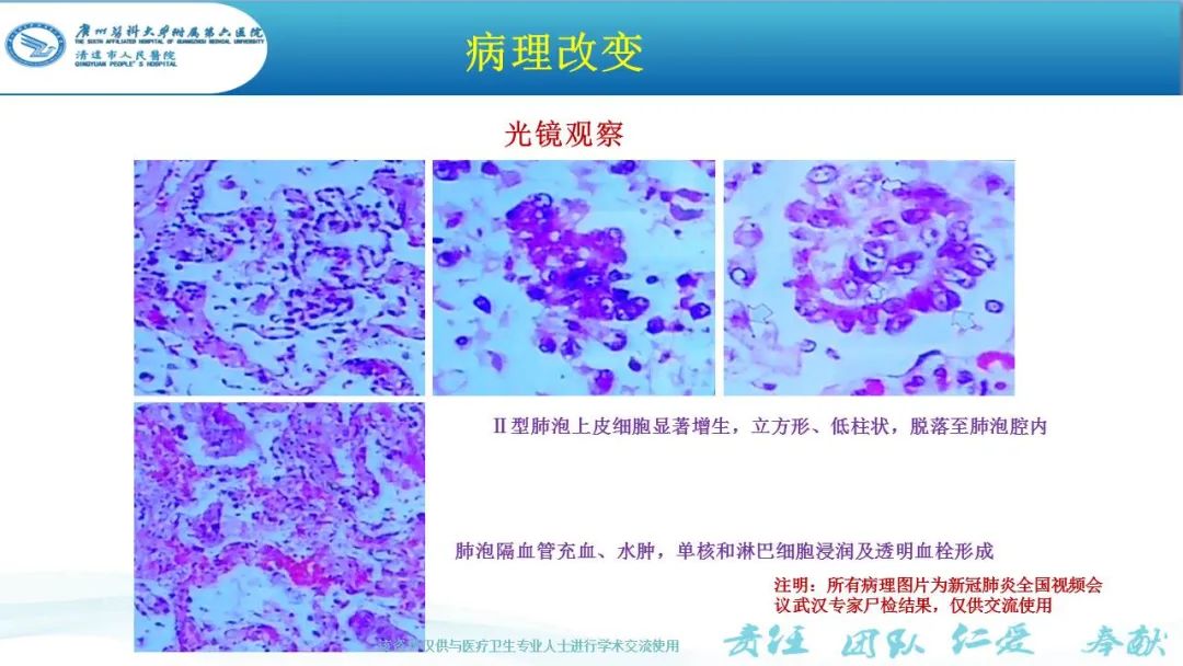 【PPT】新冠病毒肺炎影像学表现
