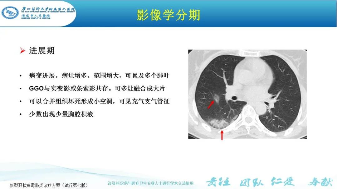 【PPT】新冠病毒肺炎影像学表现