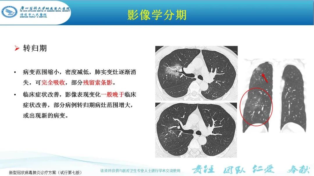 【PPT】新冠病毒肺炎影像学表现
