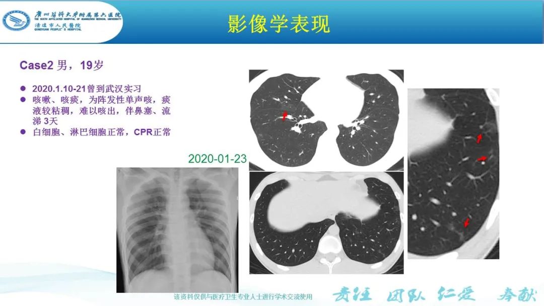 【PPT】新冠病毒肺炎影像学表现