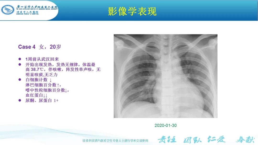 【PPT】新冠病毒肺炎影像学表现