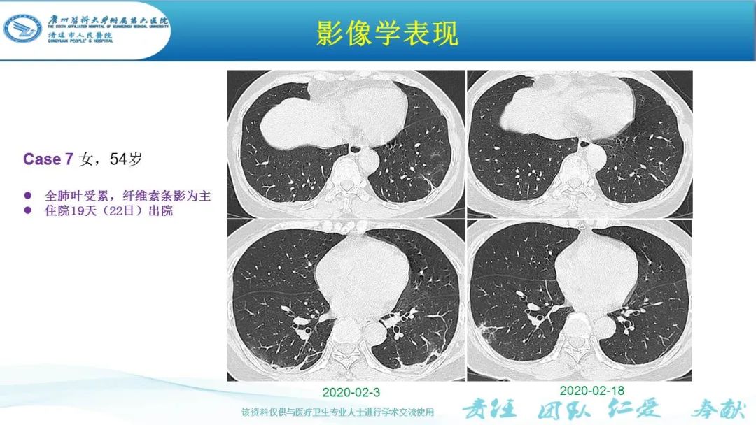 【PPT】新冠病毒肺炎影像学表现