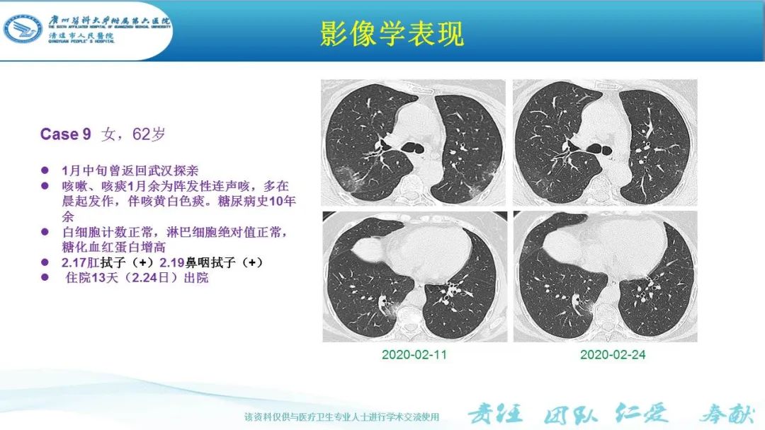 【PPT】新冠病毒肺炎影像学表现