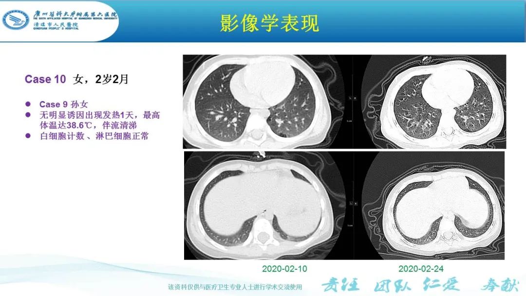 【PPT】新冠病毒肺炎影像学表现