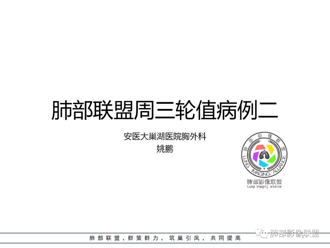 【病例】结核居然也能有晕征 【病例】结核居然也能有晕征