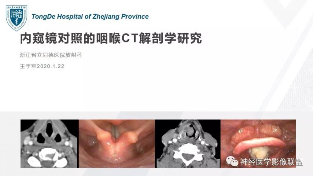 【PPT】内窥镜对照的喉部CT解剖学研究