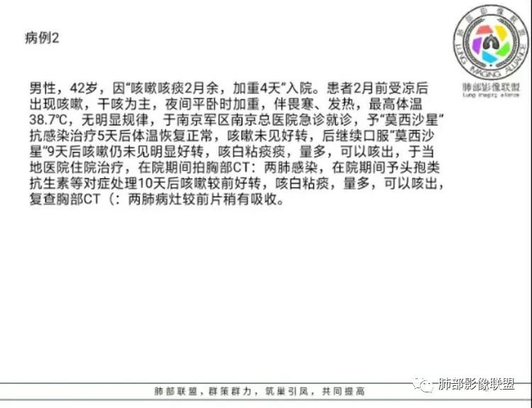 【病例】 肺白塞氏病1例CT影像讨论 【病例】 肺白塞氏病1例CT影像讨论