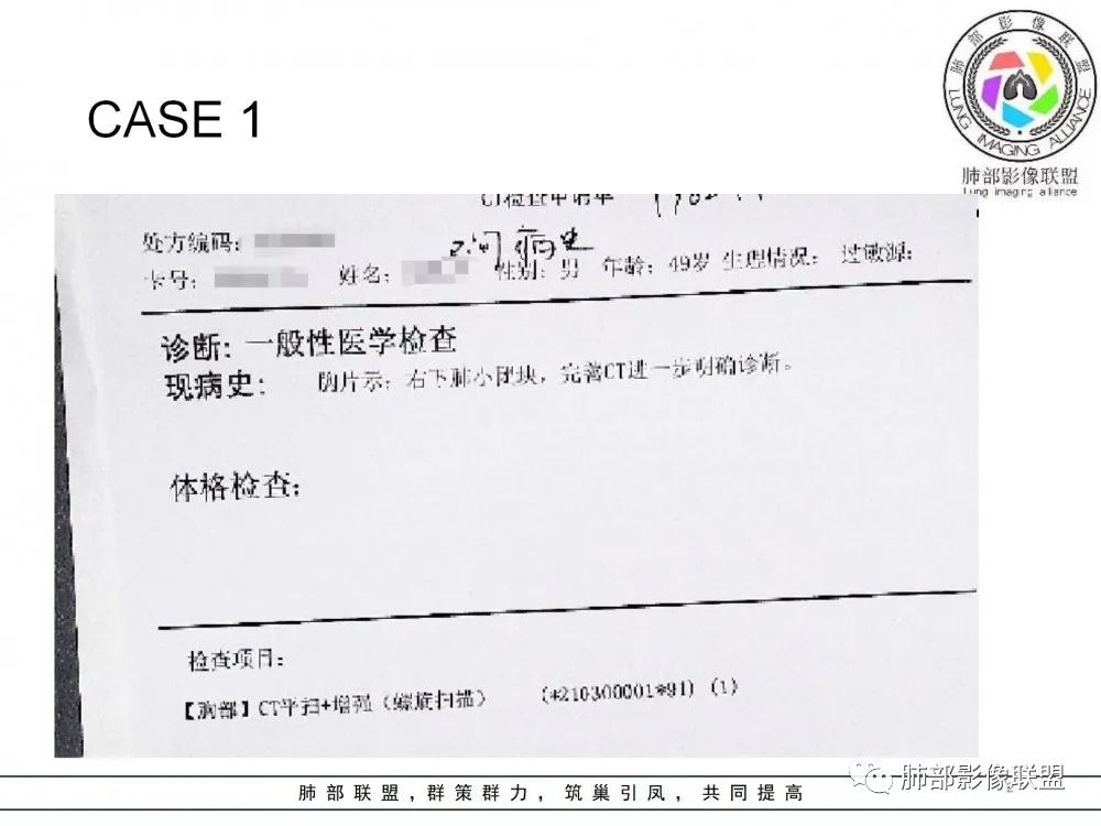 【病例】肺隐球菌病2例CT影像讨论 【病例】肺隐球菌病2例CT影像讨论