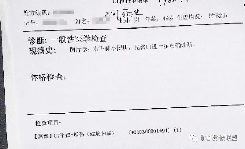【病例】肺隐球菌病2例CT影像讨论 【病例】肺隐球菌病2例CT影像讨论