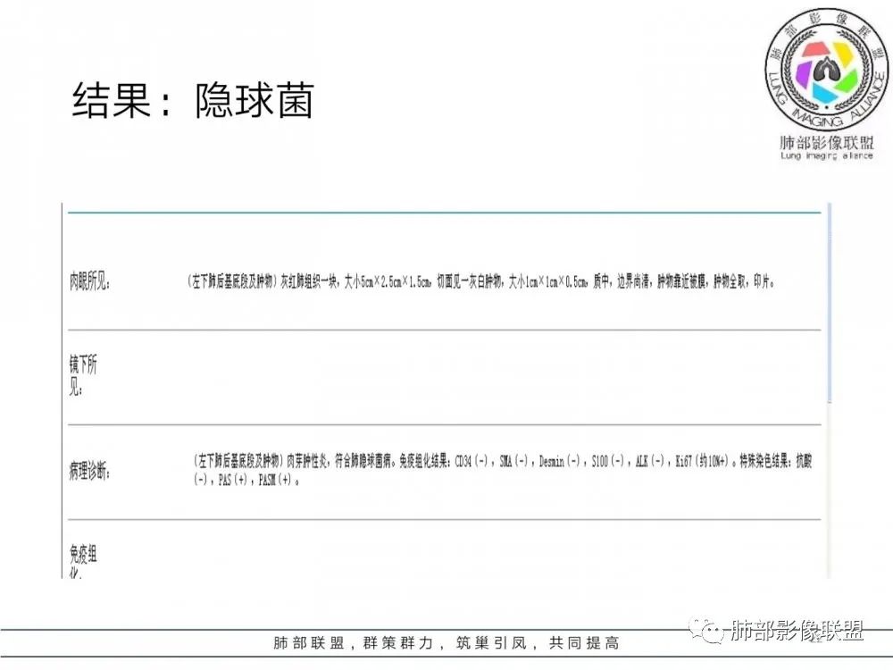 【病例】肺隐球菌病2例CT影像讨论 【病例】肺隐球菌病2例CT影像讨论