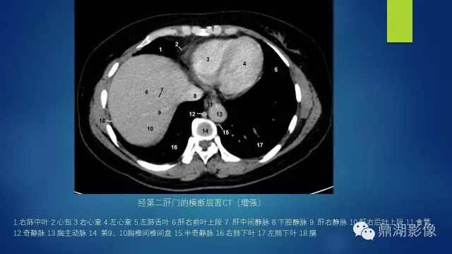 腹部CT超全断层解剖