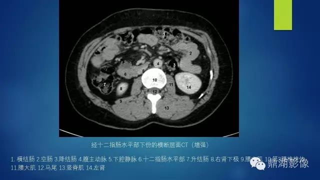腹部CT超全断层解剖