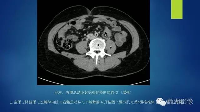 腹部CT超全断层解剖