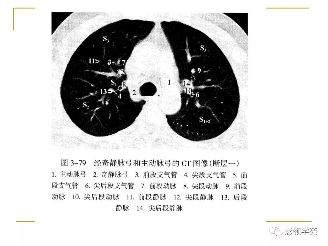 肺段与肺内管道应用解剖 肺段与肺内管道应用解剖