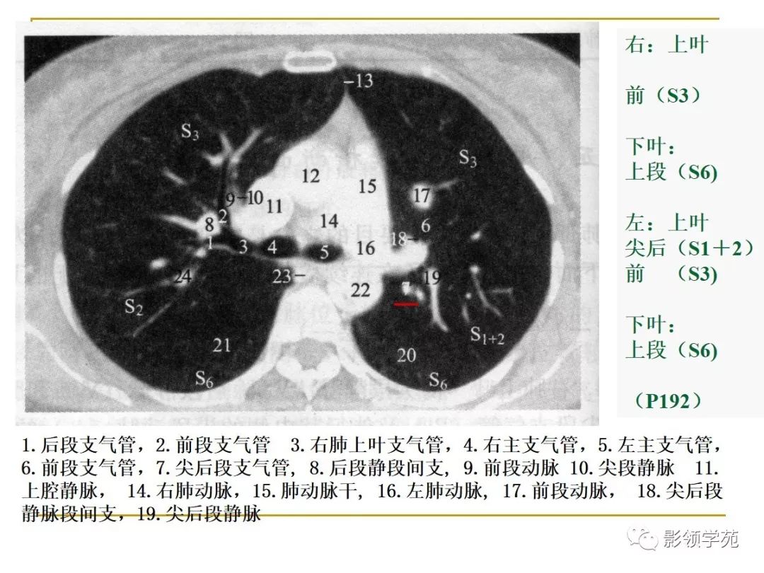肺段与肺内管道应用解剖 肺段与肺内管道应用解剖